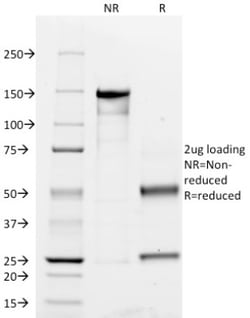 CD45RO Antibody (UCHL-1), Novus Biologicals 0.1mg; Unlabeled:Antikörper